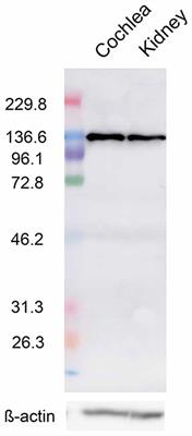 Calcium-Sensing Receptor Is Functionally Expressed in the Cochlear Perilymphatic Compartment and Essential for Hearing